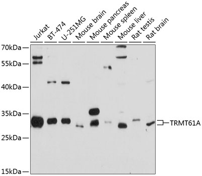 TRMT61A Polyclonal Antibody - Absci