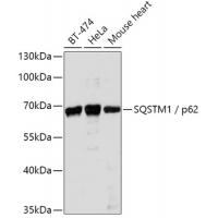 SQSTM1 / p62 Polyclonal Antibody