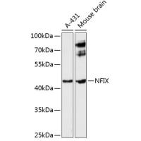 NFIX Polyclonal Antibody
