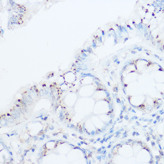 UBIAD1 Rabbit Polyclonal Antibody - Absci