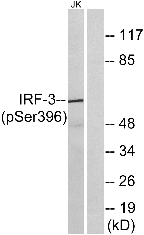 IRF-3 (phospho Ser396) Polyclonal Antibody - Absci
