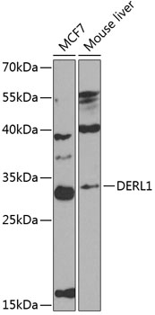 DERL1 Polyclonal Antibody - Absci