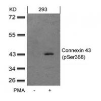 Connexin 43(phospho-Ser368) Antibody