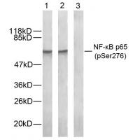 NFκB-p65(Phospho-Ser276) Antibody