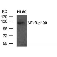 NFkB-p100(Ab-870) Antibody