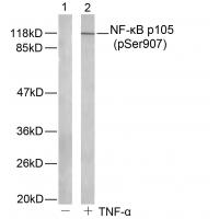 NFκB-p105(Phospho-Ser907) Antibody