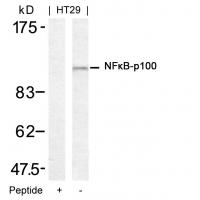 NFkB-p100(Ab-872) Antibody