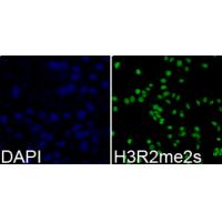 Histone H3R2me2s Polyclonal Antibody