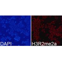 Histone H3R2me2a Polyclonal Antibody