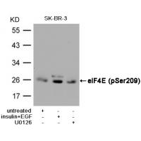 eIF4E(Phospho-Ser209) Antibody