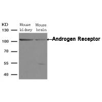 Androgen Receptor(Ab-650) Antibody