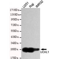 UCHL1/PGP9.5 Monoclonal Antibody