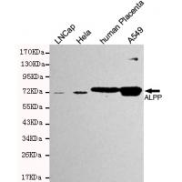 Placental alkaline phosphatase (PLAP) Monoclonal Antibody