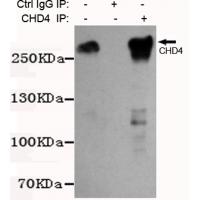 CHD4 Monoclonal Antibody