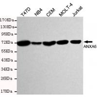 Annexin VI Monoclonal Antibody