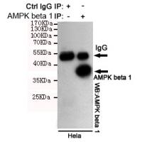 AMPK beta 1 Monoclonal Antibody