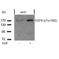 EGFR(Phospho-Tyr1092) Antibody