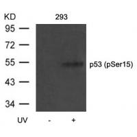 p53(Phospho-Ser15) Antibody