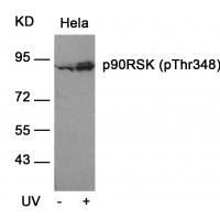 p90RSK(Phospho-Thr348) Antibody