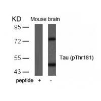 Tau(Phospho-Thr181) Antibody