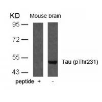 Tau(Phospho-Thr231) Antibody