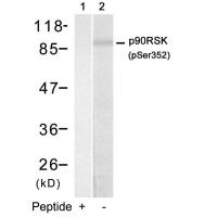 p90RSK(Phospho-Ser352) Antibody