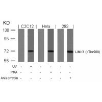LIMK1(Phospho-Thr508) Antibody