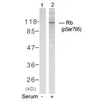 Rb(Phospho-Ser795) Antibody