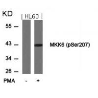 MKK6(Phospho-Ser207) Antibody