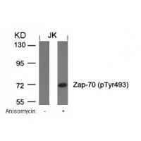 Zap-70(Phospho-Tyr493) Antibody