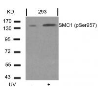 SMC1(Phospho-Ser957) Antibody