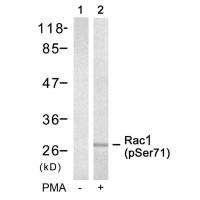Rac1(Phospho-Ser71) Antibody