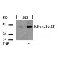 IkB-e(Phospho-Ser22) Antibody