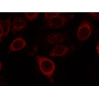 mTOR(Phospho-Ser2448) Antibody