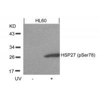 HSP27(Phospho-Ser78) Antibody