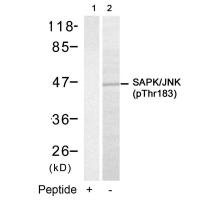 SAPK/JNK(Phospho-Thr183) Antibody