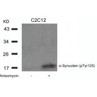a-Synuclein(Phospho-Tyr125) Antibody