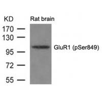 GluR1(phospho-Ser849) Antibody