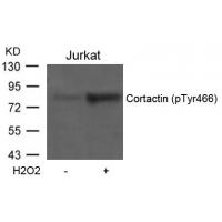 Cortactin(Phospho-Tyr466) Antibody