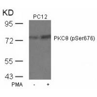PKCth(Phospho-Ser676) Antibody