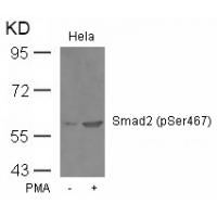Smad2(Phospho-Ser467) Antibody