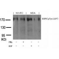EGFR(phospho-Tyr1197) Goat Polyclonal Antibody
