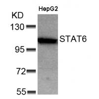 STAT6(Ab-641) Antibody