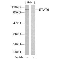 STAT6(Ab-645) Antibody