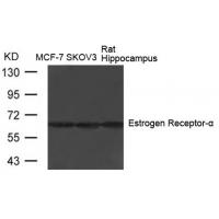 Estrogen Receptor-a(Ab-104) Antibody