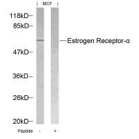 Estrogen Receptor-a(Ab-118) Antibody