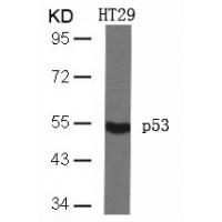 p53(Ab-46) Antibody