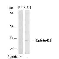 Ephrin-B2(Ab-316) Antibody