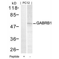 GABRB1(Ab-434) Antibody