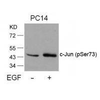 c-Jun(Phospho-Ser73) Antibody